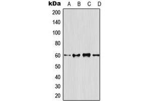 Western blot analysis of Osteoprotegerin expression in HeLa (A), mouse brain (B), rat brain (C), PC12 (D) whole cell lysates.