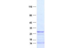 Western Blotting (WB) image for Slow Skeletal Troponin I (TNNI1) protein (DYKDDDDK Tag) (ABIN2732110)