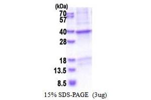 CRHBP Protein (AA 22-322) (His tag)