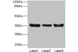 Western blot All lanes: ZNF625 antibody at 4 μg/mL Lane 1: Mouse brain tissue Lane 2: Mouse lung tissue Lane 3: Mouse ovarian tissue Secondary Goat polyclonal to rabbit IgG at 1/10000 dilution Predicted band size: 35, 43 kDa Observed band size: 35 kDa (ZNF625 Antikörper  (AA 1-306))