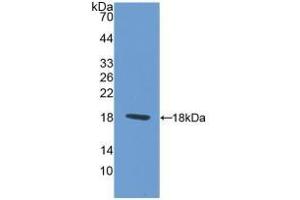 Detection of Recombinant PAX6, Rat using Polyclonal Antibody to Paired Box Gene 6 (PAX6) (PAX6 Antikörper  (AA 1-130))