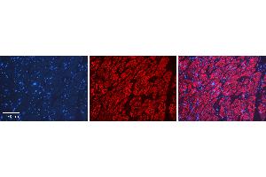 Rabbit Anti-LSM1 Antibody   Formalin Fixed Paraffin Embedded Tissue: Human heart Tissue Observed Staining: Cytoplasmic Primary Antibody Concentration: N/A Other Working Concentrations: 1:600 Secondary Antibody: Donkey anti-Rabbit-Cy3 Secondary Antibody Concentration: 1:200 Magnification: 20X Exposure Time: 0.