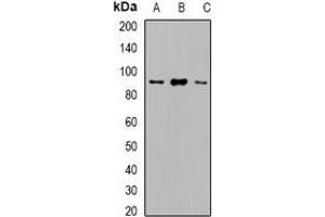 Western blot analysis of VPS35 expression in Hela (A), HepG2 (B), Raji (C) whole cell lysates.