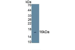 Detection of Recombinant CD160, Human using Monoclonal Antibody to Cluster Of Differentiation 160 (CD160) (CD160 Antikörper  (AA 37-154))