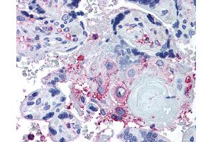 Immunohistochemistry (IHC) image for anti-ADAM Metallopeptidase with thrombospondin Type 1 Motif, 5 (ADAMTS5) (Internal Region) antibody (ABIN1048293)