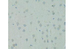 Immunohistochemistry of paraffin-embedded Rat brain using SMAD6 Polyclonal Antibody at dilution of 1:100 (40x lens). (SMAD6 Antikörper)
