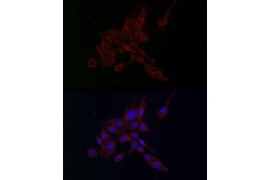 Immunofluorescence analysis of PC-12 cells using MMP2 antibody (ABIN6129301, ABIN6143911, ABIN6143913 and ABIN6221846) at dilution of 1:100.