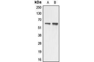 Western blot analysis of AATF expression in HUVEC (A), HeLa (B) whole cell lysates.