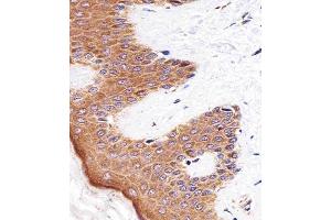 Immunohistochemical analysis of paraffin-embedded H. (BLMH Antikörper  (AA 212-242))