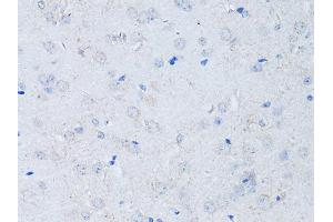 Immunohistochemistry of paraffin-embedded mouse brain using RYR2 Antibody (ABIN5970123) at dilution of 1/100 (40x lens). (RYR2 Antikörper)