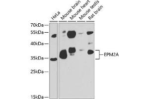 Western blot analysis of extracts of various cell lines, using EPM2A antibody (ABIN6131609, ABIN6140229, ABIN6140230 and ABIN6222778) at 1:1000 dilution. (EPM2A Antikörper  (AA 244-331))