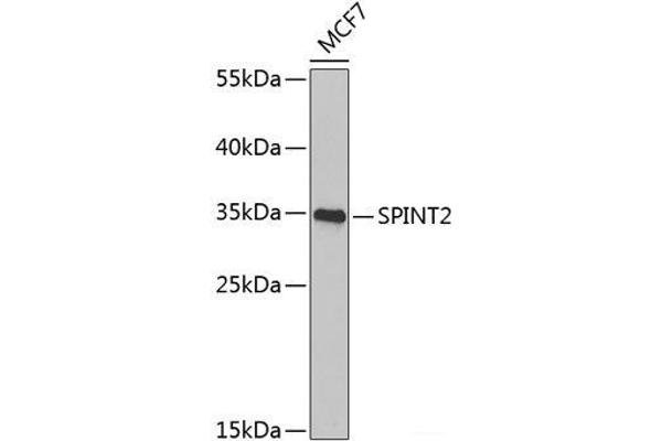 SPINT2 抗体