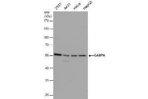 WB Image GABPA antibody detects GABPA protein by western blot analysis. (GABPA Antikörper  (Internal Region))
