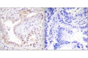 Immunohistochemistry (IHC) image for anti-Lamin A/C (LMNA) (AA 212-261), (Cleaved-Asp230) antibody (ABIN1536093)