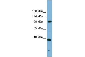 WB Suggested Anti-ERCC4 Antibody Titration: 0. (ERCC4 Antikörper  (Middle Region))