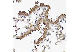 Immunohistochemistry of paraffin-embedded mouse lung using  Rabbit mAb (ABIN7265788) at dilution of 1:100 (40x lens). (ATG12 Antikörper)