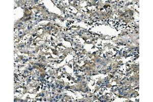 anti-Aldo-Keto Reductase Family 1, Member D1 (AKR1D1) (C-Term) antibody