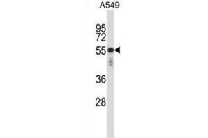 Western Blotting (WB) image for anti-Keratin 6C (KRT6C) antibody (ABIN2997801)
