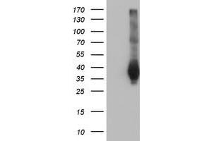 Western Blotting (WB) image for anti-Family with Sequence Similarity 84, Member B (FAM84B) antibody (ABIN1498212) (FAM84B Antikörper)