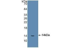 Detection of Recombinant FGb, Human using Polyclonal Antibody to Fibrinogen Beta Chain (FGB) (Fibrinogen beta Chain Antikörper  (AA 29-118))