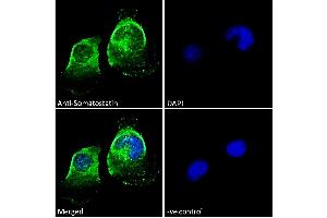 ABIN7013881 Immunofluorescence analysis of paraformaldehyde fixed U251 cells, permeabilized with 0.
