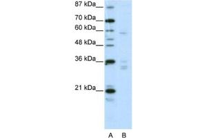 Western Blotting (WB) image for anti-Zinc Finger Protein 440 (ZNF440) antibody (ABIN2461986) (ZNF440 Antikörper)