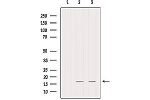 Western Blotting (WB) image for anti-Intraflagellar Transport 20 Homolog (IFT20) antibody (ABIN6262478)