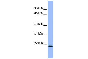 WB Suggested Anti-RHEB Antibody Titration: 0. (RHEB Antikörper  (Middle Region))