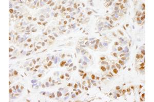 Immunohistochemistry (IHC) image for anti-PHD Finger Protein 8 (PHF8) (AA 650-700) antibody (ABIN7448725) (PHF8 Antikörper  (AA 650-700))