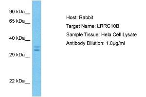 Host: Rabbit Target Name: LRRC10B Sample Type: Hela Whole Cell lysates Antibody Dilution: 1. (LRRC10B Antikörper  (C-Term))