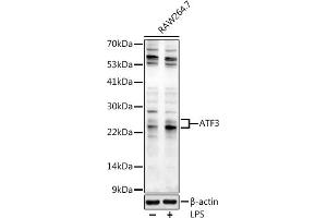 Western blot analysis of extracts of R. (ATF3 Antikörper  (AA 1-181))