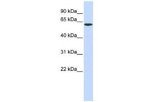 SPTLC1 antibody used at 1 ug/ml to detect target protein. (SPTLC1 Antikörper  (Middle Region))