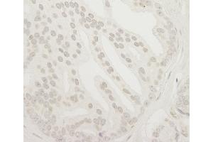 Immunohistochemistry (IHC) image for anti-Ubiquitin Specific Peptidase 37 (USP37) (C-Term) antibody (ABIN7448856) (USP37 Antikörper  (C-Term))
