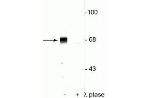 Western blot of rat hippocampal lysate showing specific immunolabeling of the ~68 kDa to ~70 kDa PAK protein phosphorylated at Ser402 in the first lane (-). (PAK1 Antikörper  (pThr402))