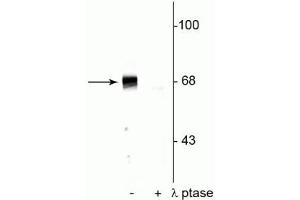 Western blot of rat hippocampal lysate showing specific immunolabeling of the ~68 kDa to ~70 kDa PAK protein phosphorylated at Ser402 in the first lane (-). (PAK1-3 (pThr402) Antikörper)