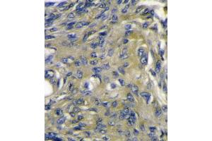 VEGFD (VEGF4) Antibody immunohistochemistry analysis in formalin fixed and paraffin embedded mouse heart tissue followed by peroxidase conjugation of the secondary antibody and DAB staining.