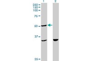 Western Blot analysis of TTC4 expression in transfected 293T cell line by TTC4 monoclonal antibody (M09), clone 1E10.