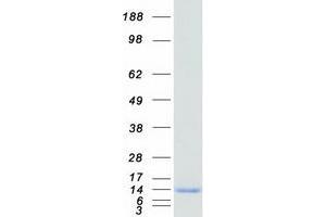 Western Blotting (WB) image for S100 Calcium Binding Protein A14 (S100A14) protein (Myc-DYKDDDDK Tag) (ABIN2731301)