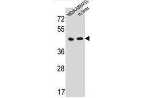 Western blot analysis of HTR4 Antibody (N-term) in MDA-MB453 cell line and mouse liver tissue lysates (35ug/lane). (Serotonin Receptor 4 Antikörper  (N-Term))