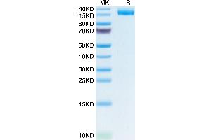 Human LIF R/CD118 on Tris-Bis PAGE under reduced condition. (LIFR Protein (AA 45-833) (His tag))