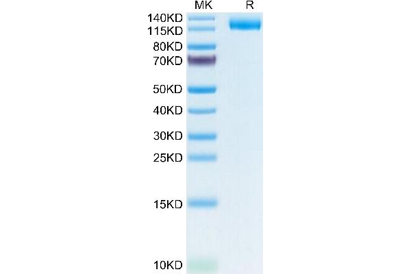LIFR Protein (AA 45-833) (His tag)
