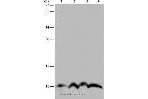 Western blot analysis of SKOV3 cell and human fetal liver tissue, human fetal brain tissue and Hela cell, using NDUFA4 Polyclonal Antibody at dilution of 1:300 (NDUFA4 Antikörper)