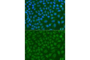 Immunofluorescence analysis of A549 cell using SSX5 antibody. (SSX5 Antikörper)