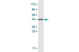 Western Blot detection against Immunogen (47. (DDX60 Antikörper  (AA 1-183))