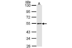WB Image Sample (30 ug of whole cell lysate) A: H1299 10% SDS PAGE antibody diluted at 1:1000 (RAD23A Antikörper  (Center))