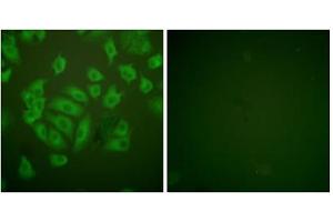 Immunofluorescence analysis of A549 cells, using Stefin A antibody. (CSTA Antikörper  (Internal Region))