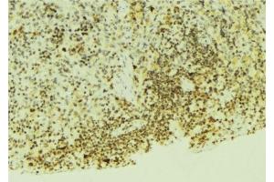 ABIN6276554 at 1/100 staining Mouse pancreas tissue by IHC-P. (EGLN1 Antikörper  (Internal Region))
