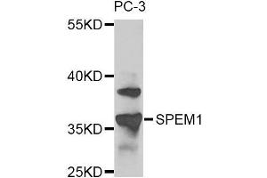 Western blot analysis of extracts of PC-3 cells, using SPEM1 antibody. (SPEM1 Antikörper)