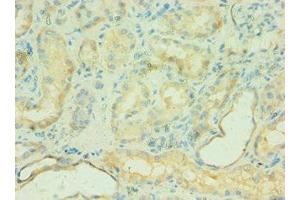 Immunohistochemistry of paraffin-embedded human kidney tissue using ABIN7146168 at dilution of 1:100 (C4BPB Antikörper  (AA 18-252))