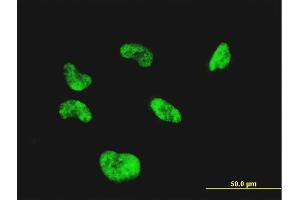 Immunofluorescence of monoclonal antibody to CGGBP1 on HeLa cell.
